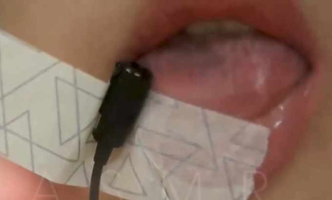 coconut椰砸 ASMR 领夹麦天亚克力板 F啃领夹麦 电流直升机